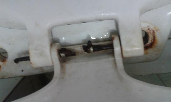 dirty toilet seat hinge